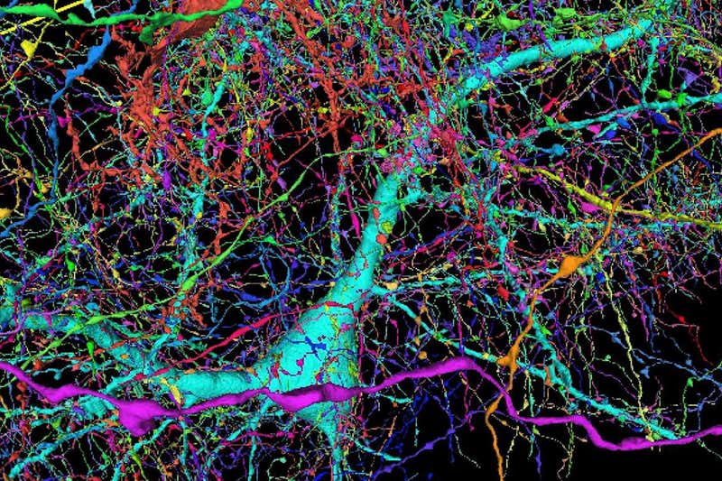 Colorized view of nerve fibres connecting to a neuron.