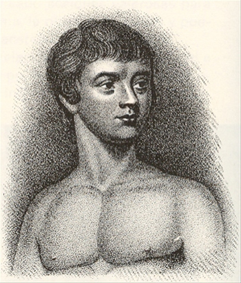 A portrait of Victor of Aveyron. 