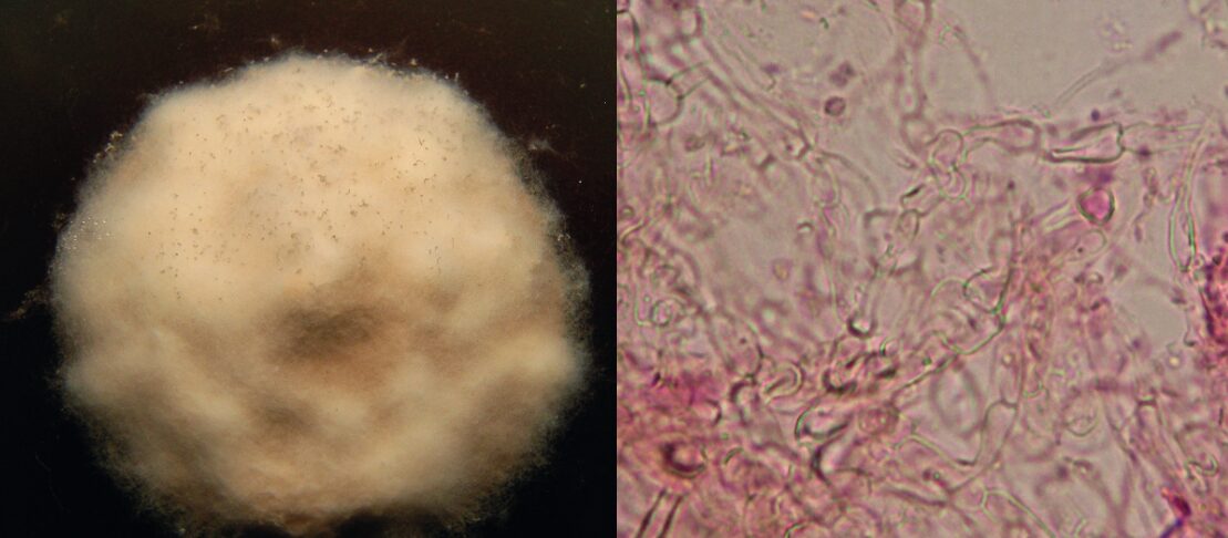 left: a mold colony, right: a microscope image of mold 