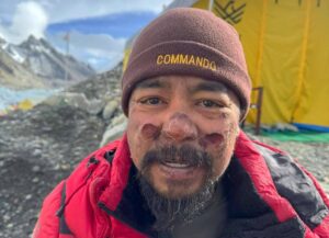 Close shot of Philipp II Santiago with sunburnt face in Everest Base Camp