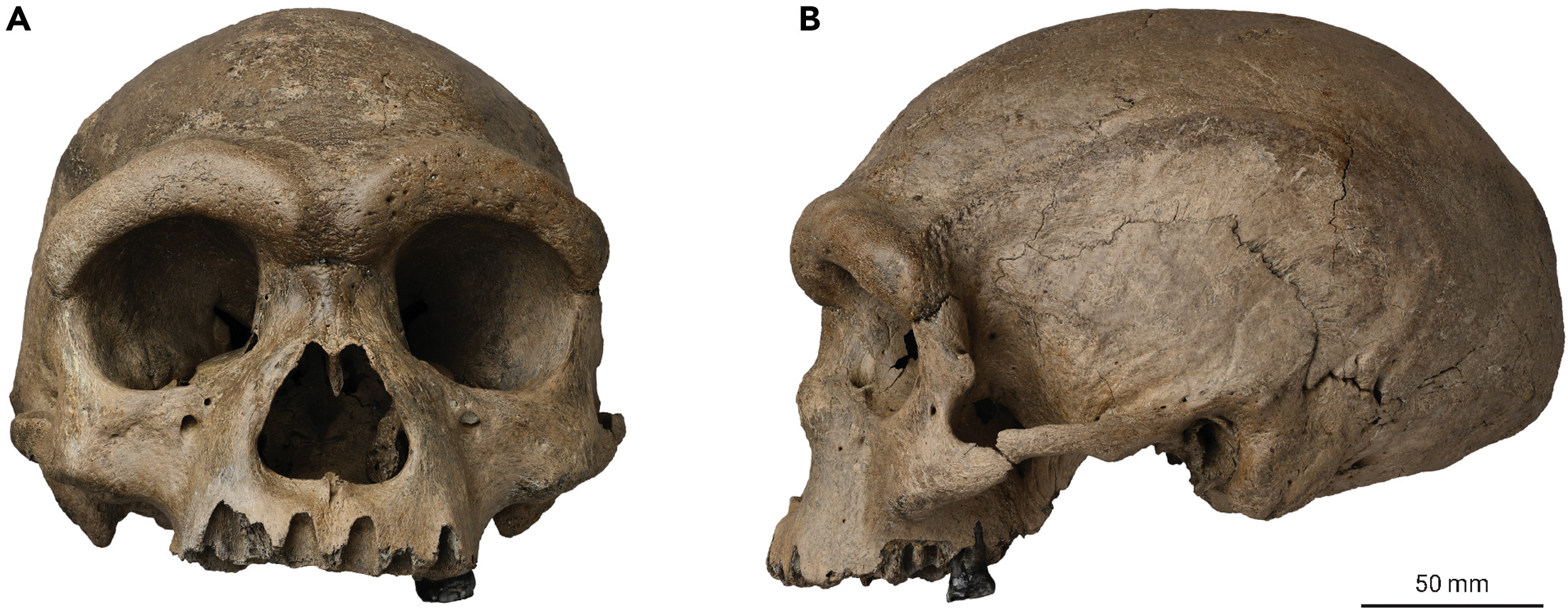 A skull for two angles