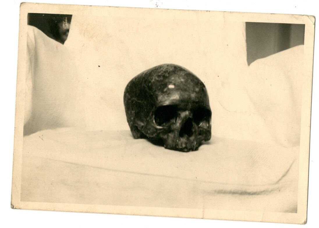 A human skull