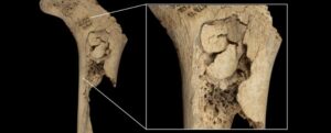 bones of ancient child