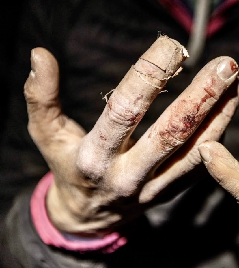 Sasha DiGiulian's fingers after the climb.