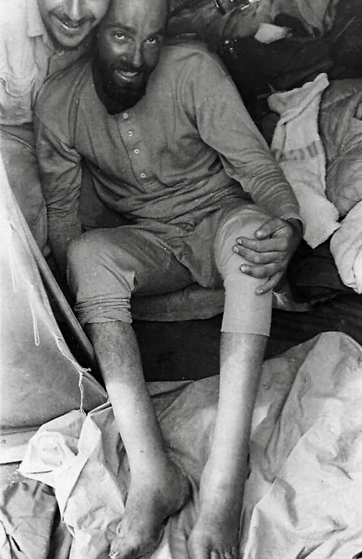 Francisco Ibanez after descent, with severe frostbite on his legs. He died later in a hospital of Kathmandu.