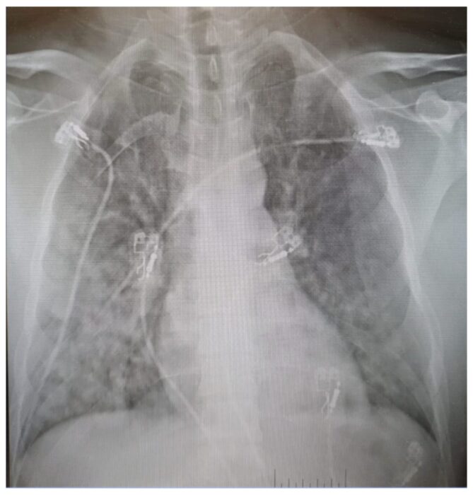 The technician's x-ray. Bases in Antarctica have some limited advanced medical facilities