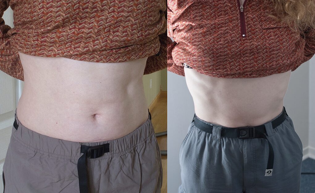 stomach muscles before/after