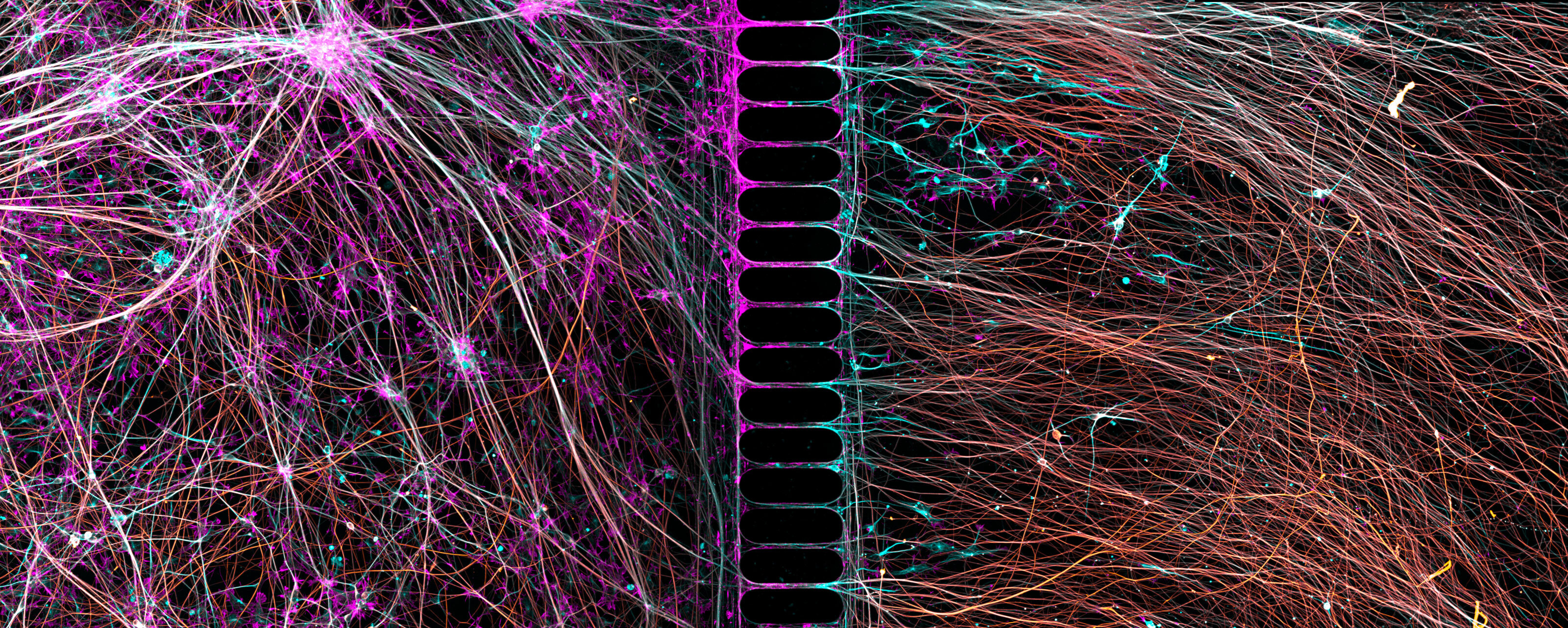 a complex network of glowing strands against a black background